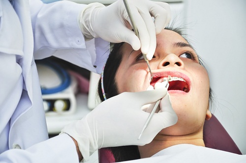 Những biến chứng của việc nhổ răng khôn hàm dưới?